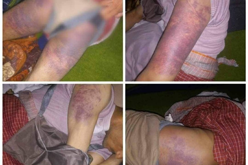 شاهد صور مرعبة.. شاب يتعرض لاعتداء وحشي من قيادي حوثي في صنعاء 