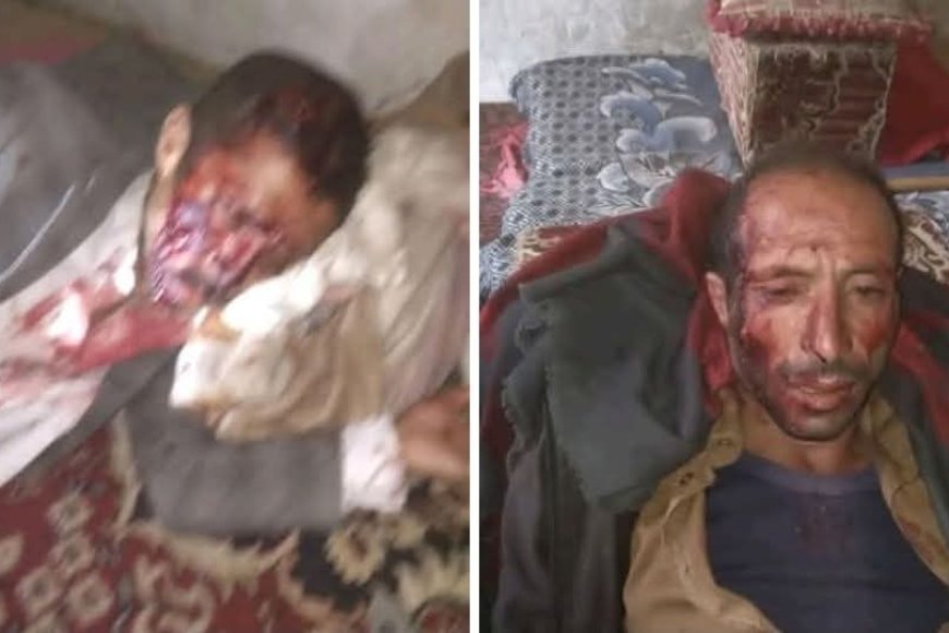 خلال معركة بالفأس..مأساة مؤلمة تهز صنعاء تتسبب بوفيات واصابات (تعرف على تفاصيل الحادثة)