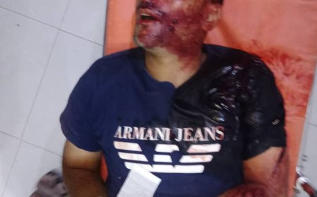 شاهد اول صورة.. لأحد المهاجمين على محل للصرافة في حضرموت لقي مصرعه 