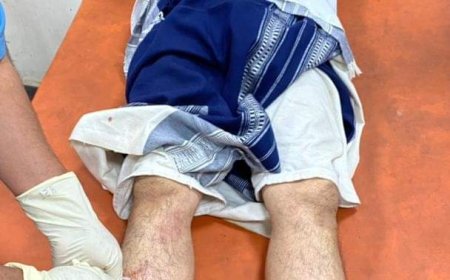 عاجل :3 جرحى جراء حادث مروري لمهندسي كهرباء تعز 