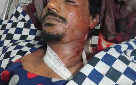 مقتل مواطن في ردفان (تفاصيل أولية)