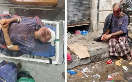 بسبب إهمال مدير مستشفى الثورة..وفاة مواطن مصاب بحالة نفسية في تعز (صور محزنة)