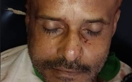 عاجل :لهذا السبب..مقتل مواطن في تعز (صورة)