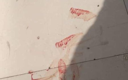 كلاب ضالة تعتدي على مواطن في تعز 