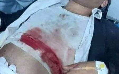 عاجل:مقتل البغدادي في تعز (صورة أولية)