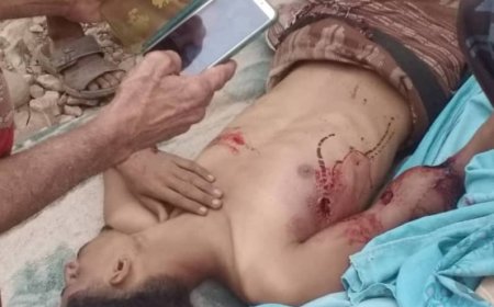 القبض على قاتل شقيقه في لحج 