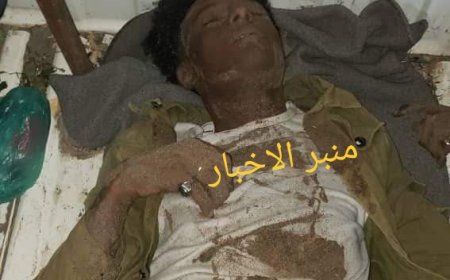 عاجل:شاهد صورة..جريمة بشعة تهتز لها الحديدة (تعرف على تفاصيلها)