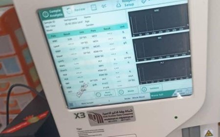 مكتب الصحة في بروم ميفع يتحصل على دعم بجهازي "CBC"