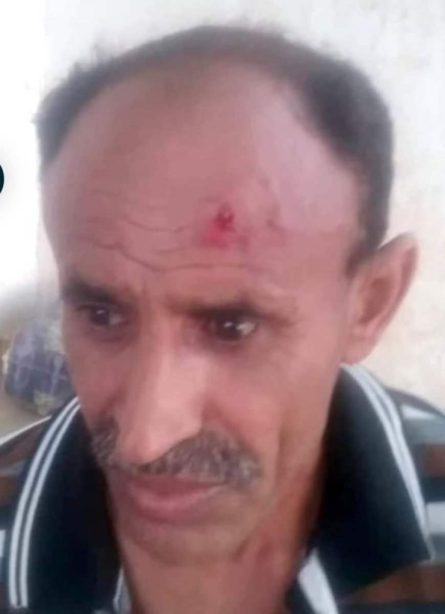 مدير أمن الحوثي بالجراحي يعتدي على أحد أفراده ويشج رأسه..