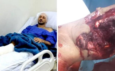 "عبدالاله" يجري عملية جراحية بقدمه اليسرى في إحدى مستشفيات القاهرة