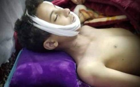 عاجل :شاب يقتل نفسه في إب (صورة)