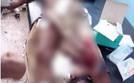 اصابة مواطن بجروح إثر انفجار مقذوف من مخلفات الحوثي في حيس..