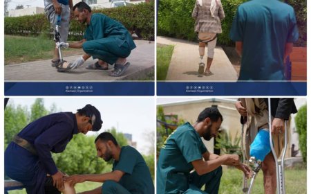 احصائيات مركز الأطراف في مأرب لشهر يوليو