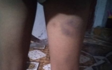 بالفيديو طفل يروي قصة تعذيبه من قبل معلمين في إحدى مدارس حجة..