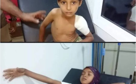 اصابة طفلين بقصف لمليشيا الحوثي استهدف منزلهما في مديرية حيس بالحديدة..