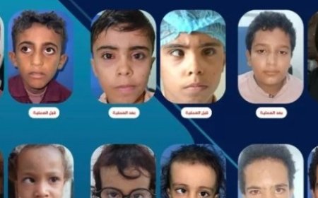 المخيم الطبي الثاني لتصحيح الحول يختتم الأسبوع الأول بنجاح....