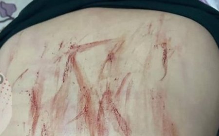 هكذا زينبيات الميليشيات الحوثية يعتدون على حرائر اليمن ..