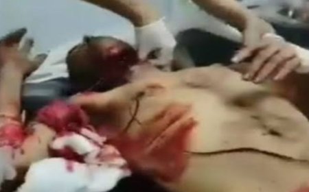 انتحار موظف في صنعاء بسبب عجزه عن دفع الإيجار..