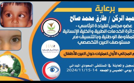برعاية العميد طارق صالح..مخيم مجاني لعمليات حول العين للأطفال في المخا