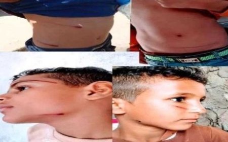 تعرض طلاب للتعذيب على يد مدير مدرسة في الضالع..