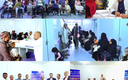 بدعم طارق صالح.. إقبال كبير في تدشين المخيم المجاني الأول لعمليات تصحيح الحول عند الأطفال في المخا