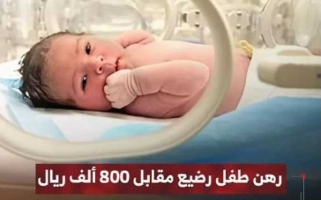 رهن طفل رضيع مقابل 800 ألف بإحدى مستشفيات إب.