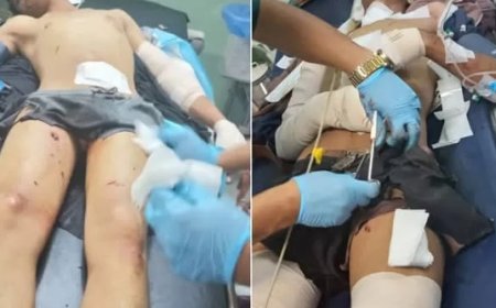إصابة شخصين بمقذوف حوثي مزروع في الضالع..