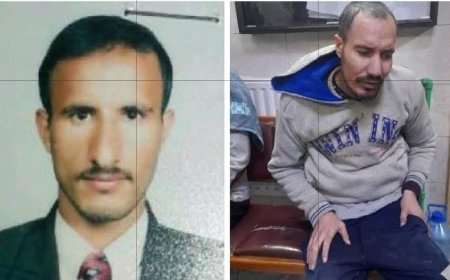 عاجل: الصورة الأكثر تداول في سوريا..تعود لطبيب يمني تعرض لابشع انواع التعذيب في سجون بشار الأسد(تعرف عليه )