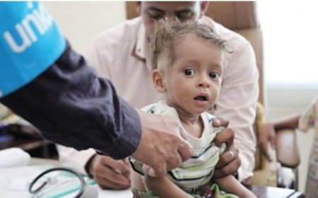 الصحة العالمية: 861 حالة وفاة بالكوليرا في اليمن خلال العام الجاري..