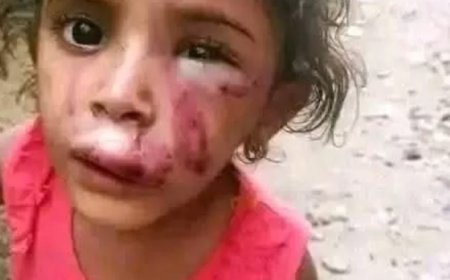 اقدام امرأة في تعز على تعذيب طفلتها بطريقة وحشية ..تعرف على السبب ...