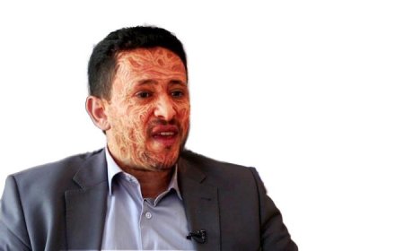 ضحايا تعذيب الحو ، ثيين يطلقون مساء الاثنين حملة لفضح جرائم المرتضى