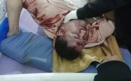 عاجل: بسبب وجبة عشاء اندلاع مواجهات عنيفة في تعز (شاهد صورة اولية للمقتول)