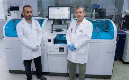 لأول مرة في اليمن: مركز المدينة الطبي يضيف جهاز كوباس بيور للخدمة الطبية