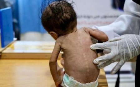 مرض خطير وغامض يجتاح المناطق الحو,,ثية وضحاياه من الأطفال ..