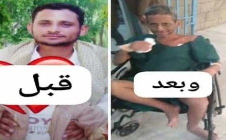 الحو,,ثيين يحولون شابا إلى رجل عجوز ..