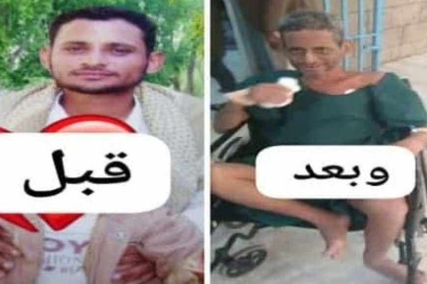 الحو,,ثيين يحولون شابا إلى رجل عجوز ..