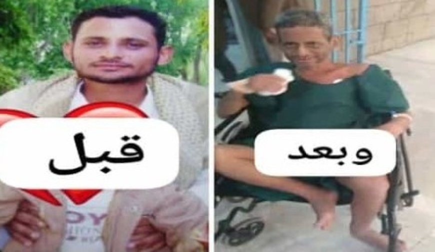 الحو,,ثيين يحولون شابا إلى رجل عجوز ..