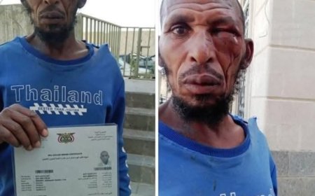 عصابة حو,,ثية تعتدي بوحشية على مواطن إثيوبي معاق في محافظة ذمار ..