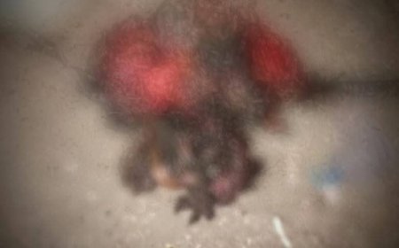 عاجل: انفجار عبوة ناسفة تتسبب بوفاة مواطن وجرح آخرين في الضالع(صورة أولية )