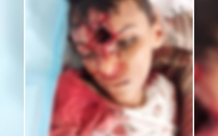 مظاهرات غاضبة في اللحية بعد مقتل طفل برصاص عنصر حو,,ثي..