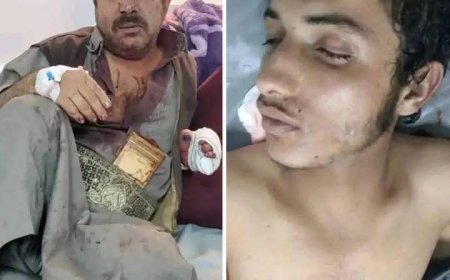 لا يصدق..هذا ماحدث بشارع الستين في صنعاء