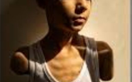 صورة طفل فلسطيني مصاب تفوز بجائزة "صورة العام"..