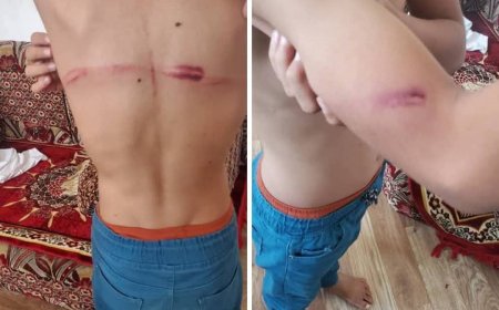 بسبب لا يصدق..مدير مركز لتحفيظ القرآن الكريم يعتدي على طالبين في مأرب(صورة مرعبة)