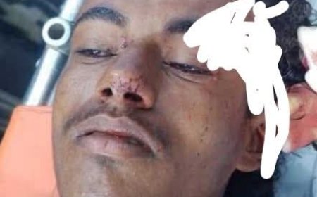 دعوات للتعرف على شاب تعرض لحادث مروع في الحديدة 