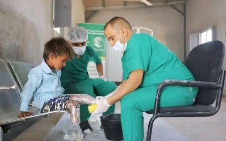صندوق المعاقين بالحديدة ينقل دفعة جديدة من ضحايا الألغام إلى مركز الأطراف الصناعية في تعز..