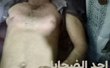 عاجل: موقع منبر الاخبار ينشر أسماء توفيا اختناقاً داخل بئر في إب