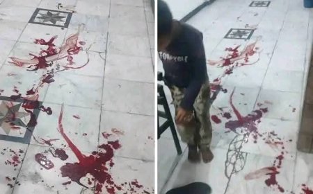 عاجل: مصدر أمني ينفي مقتل أي شخص داخل مستشفى الروضة بتعز ويوضح السبب وراء ذلك(تعرف عليه)