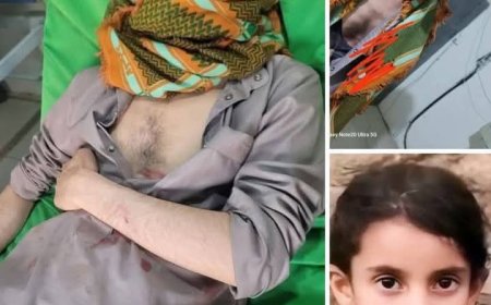 عاجل:صنعاء في مشهد خطير..أهالي الجاني يعتدوا على والد الطفلة "جنات" للضغط عليه للتنازل عن القضية