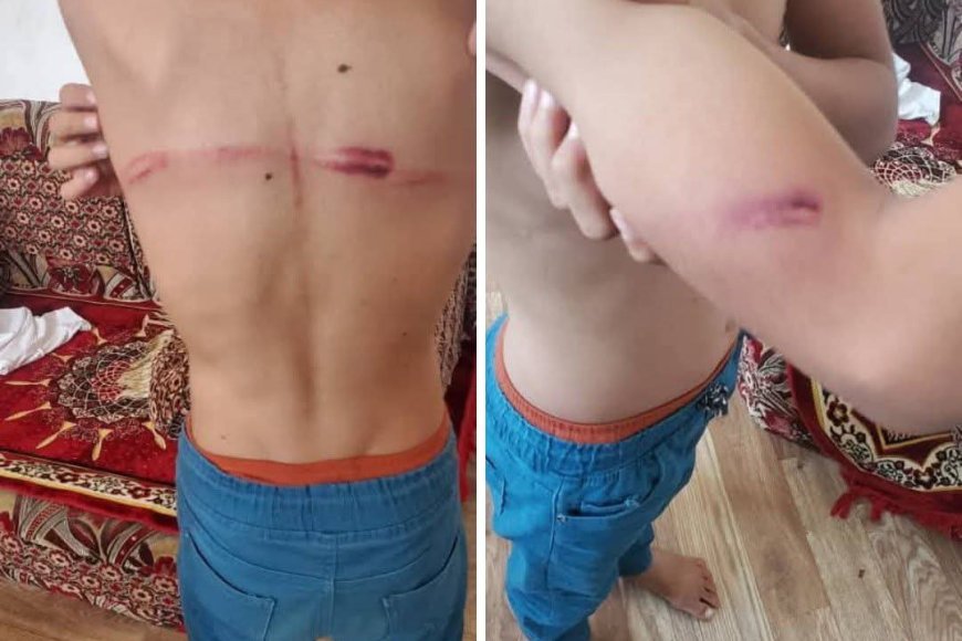 بسبب لا يصدق..مدير مركز لتحفيظ القرآن الكريم يعتدي على طالبين في مأرب(صورة مرعبة)