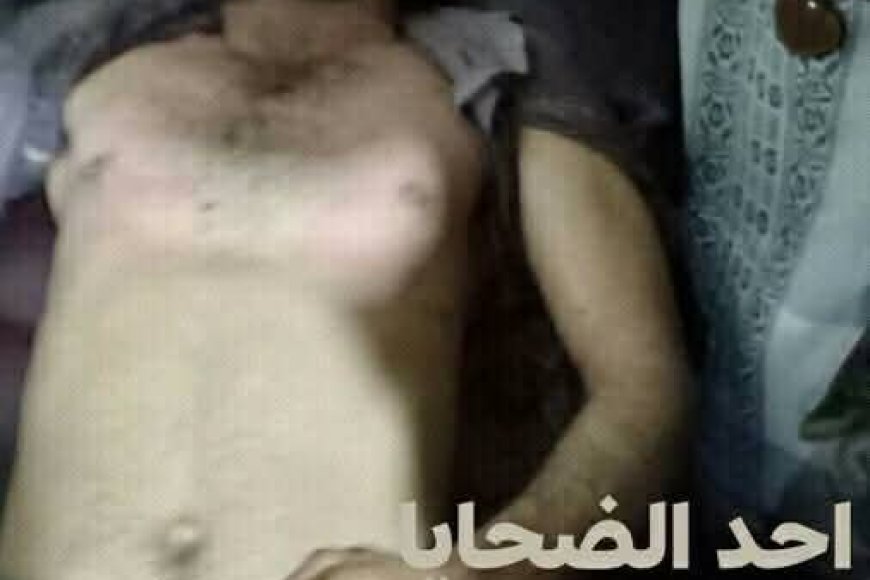 عاجل: مأساة في محافظة إب –وفاة 6 شبان إثر اختناق داخل بئر